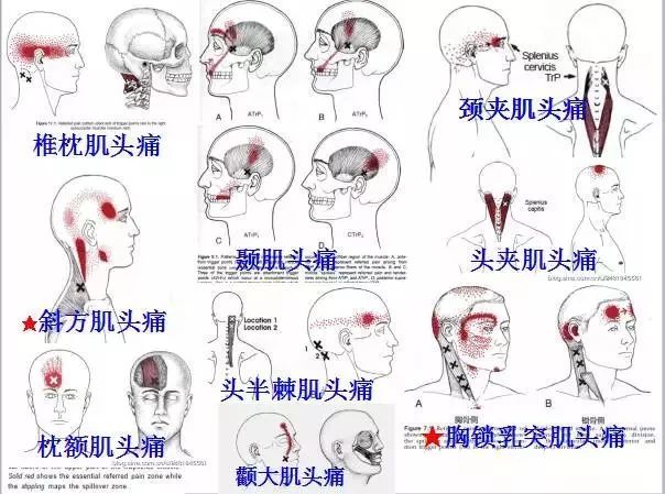 二,颈部