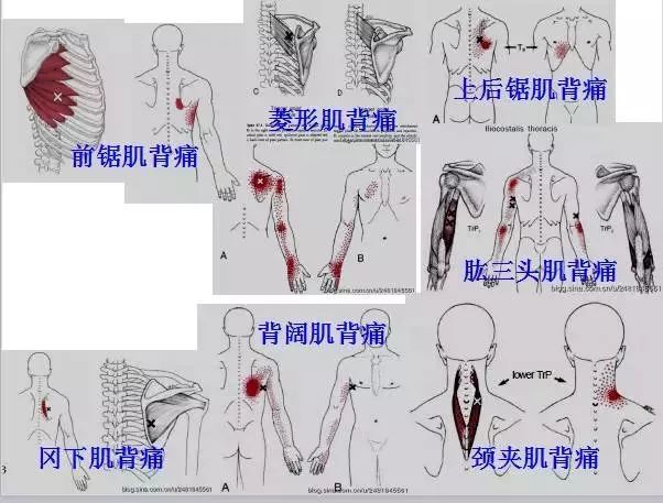 全身激痛点手册图文全解