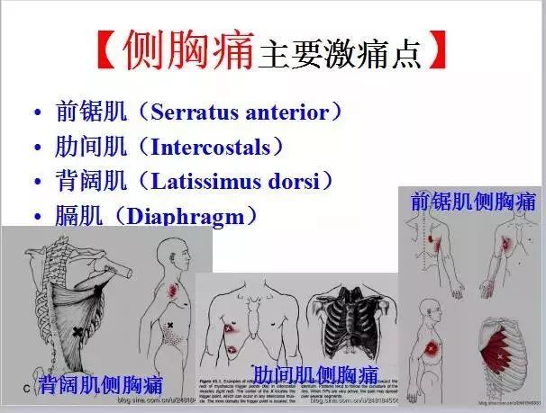 全身激痛点手册图文全解