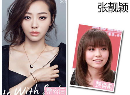星座女星整容大变脸,究竟谁最夸张