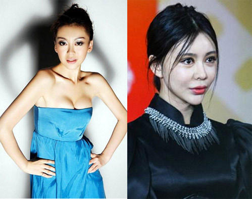 巩新亮僵脸尖下巴亮相再整容