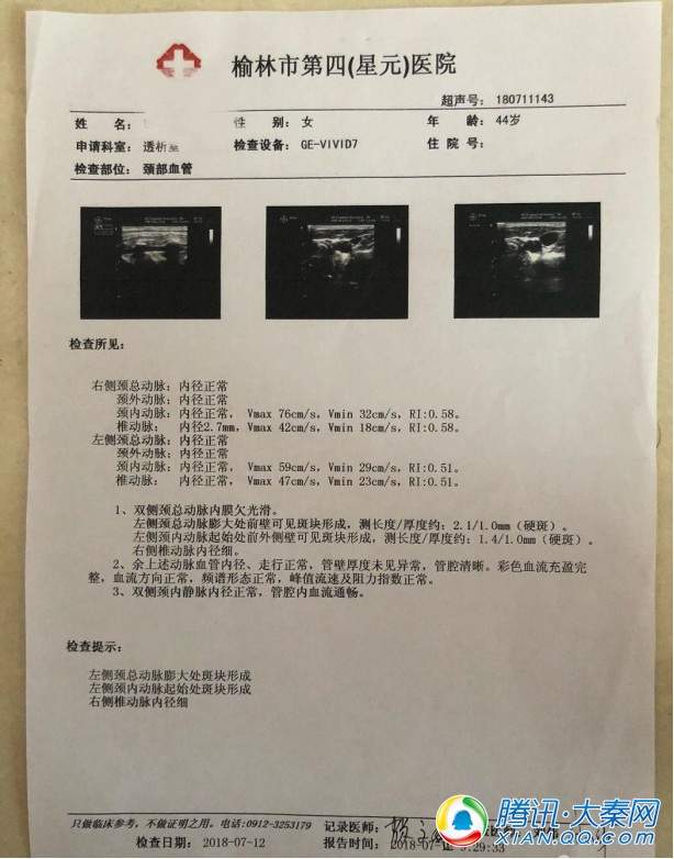 星元医院血液净化中心完成首例带涤纶套中心静脉导管置管术