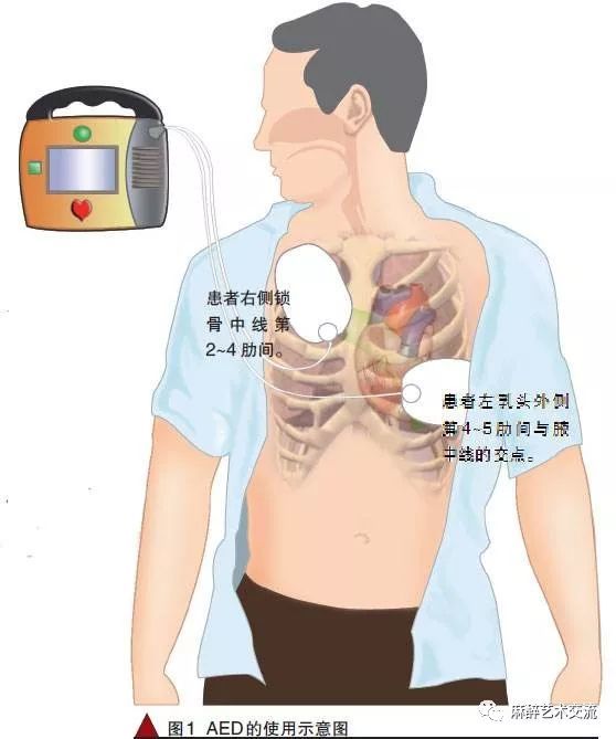 三基课堂除颤仪的使用与操作流程