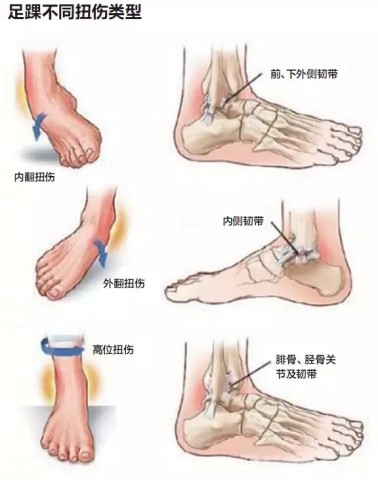 你之前的做法都是错,国青队医教你踢球如何不