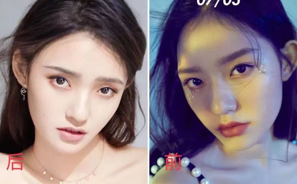 为什么林允一瘦,就从鲶鱼系变成奚梦瑶第二?