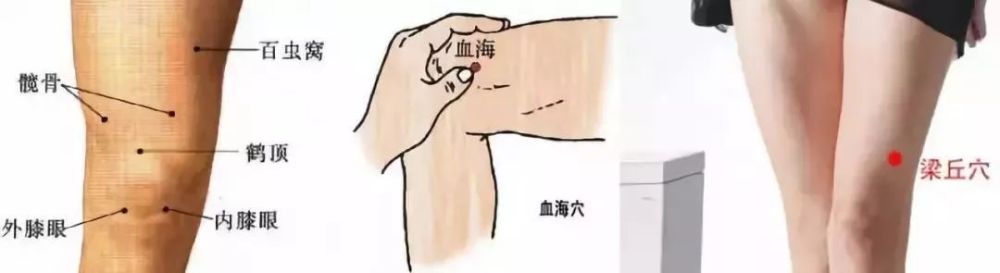 内外膝(膝盖窝下面两个眼),血海(膝盖上面两指内侧),梁丘(膝盖上两