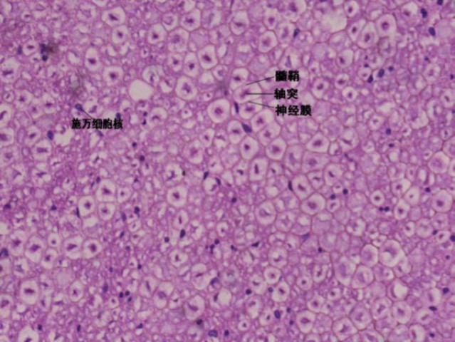 整天说神经大条,神经大条到底是怎样?