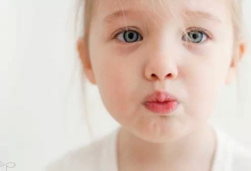 ☆新生儿脸部湿疹 家庭护理妙方