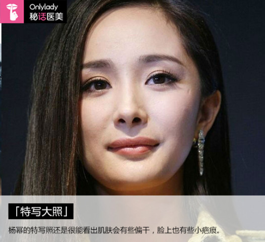 视频门|杨幂成整容范本 到底怎么才能整成杨幂