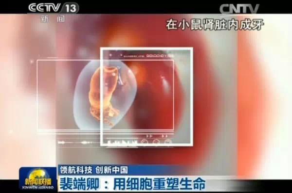 突破 | 中国科学家从尿液中 造 出牙齿 人体断肢