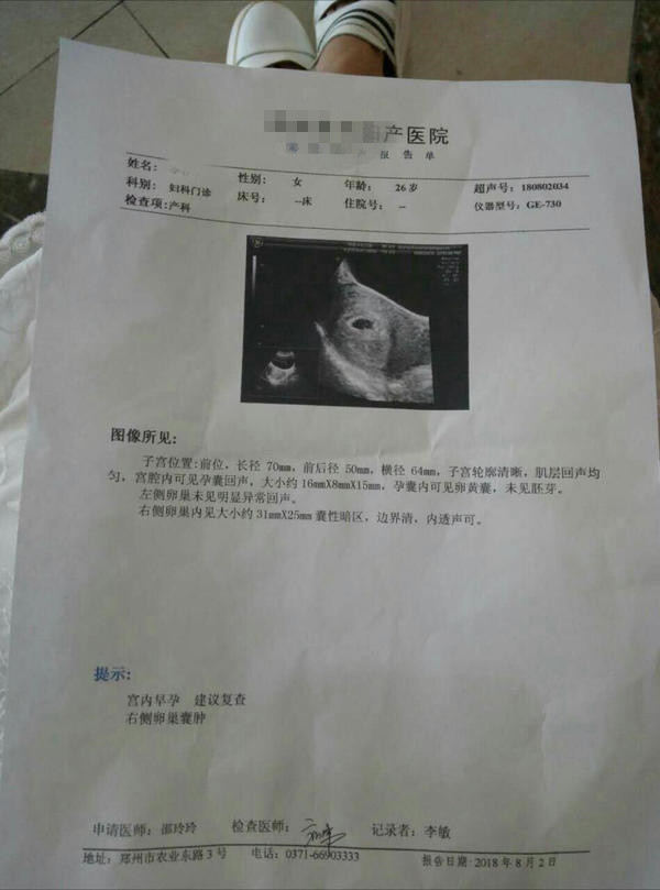 (图片说明:8月2日李雪的孕检彩超报告单显示早孕)
