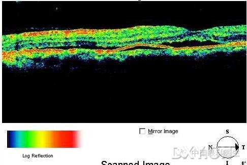 9组oct读图分析(学相干断层成像分析结果仅供参考)