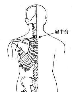 颈椎病的治疗,关键在这里