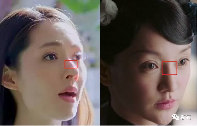 再回到周迅的鼻子,很明显她是山根处的透光.