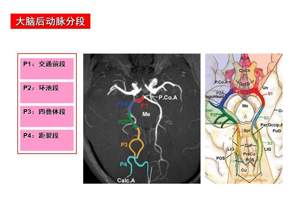 解剖| 脑动脉分段解析,详细清晰实用!