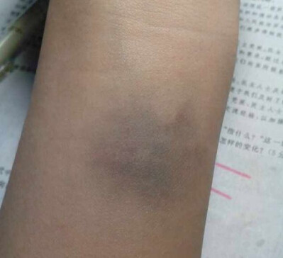 8大症状或为大病前兆