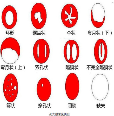 你<em>真的</em>了解<em>处女膜</em>?_订阅_腾讯网