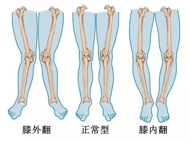 3岁~6岁 腿型开始出现膝外翻,看上去蟲行屯 .