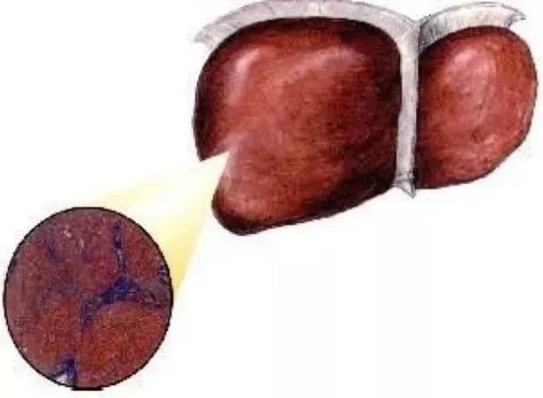 体检查出肝内钙化灶,说明离肝内胆管结石不远