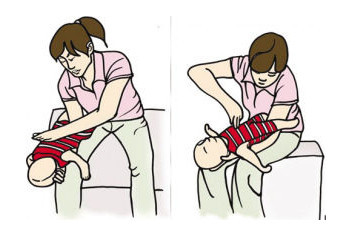 吃粽子小心噎到,一个简单动作可以救命!