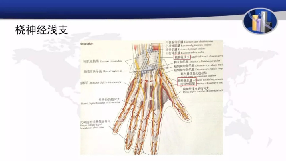 桡骨茎突狭窄性腱鞘炎