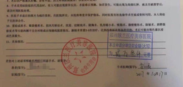 商丘大三女生分期付款做隆鼻 结果鼻孔一大一