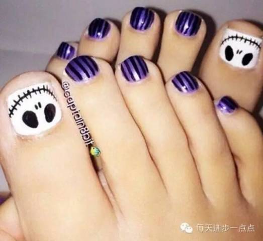 一问:为什么把长有足癣的脚叫香港脚?