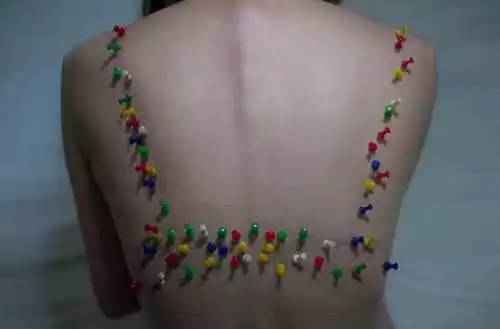 惊爆|你一看就又痛又痒