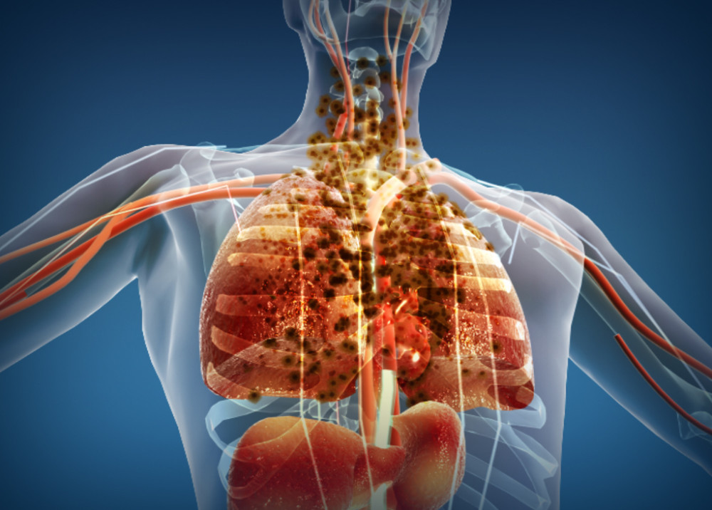 肺是人体的呼吸器官,位于胸腔,左右各一,覆盖于心之上.