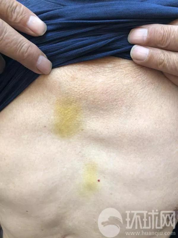 环球网:瑞典事件事发旅店称当晚无监控 当地检