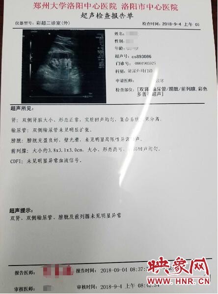 洛阳市民后腰疼痛去做检查 三家医院两种结果