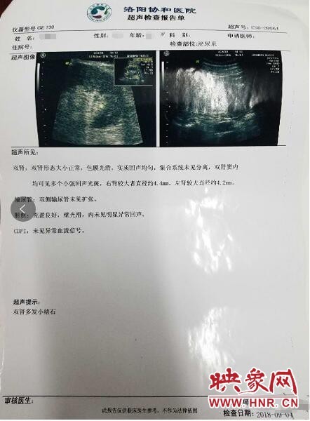 洛阳市民后腰疼痛去做检查 三家医院两种结果