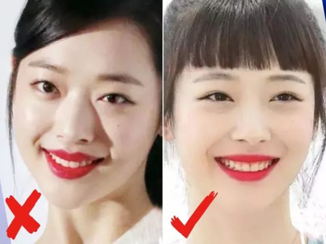 周冬雨嘴巴怎么回事?