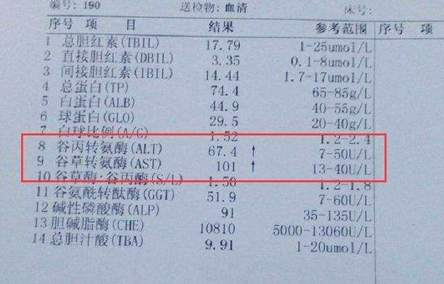 肝好不好别光看球蛋白和胆碱酯酶这2个指标更重要