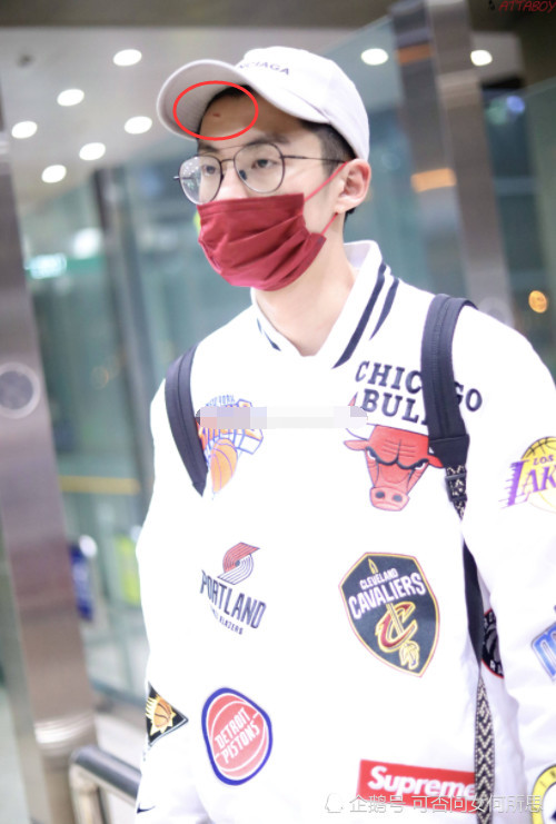 王鹤棣机场显疲惫,棒球帽也难遮额头伤疤,粉丝