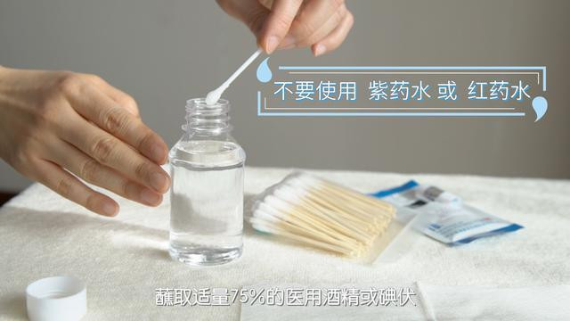 新生儿脐带护理不当会引发败血症,get正确的护理方法