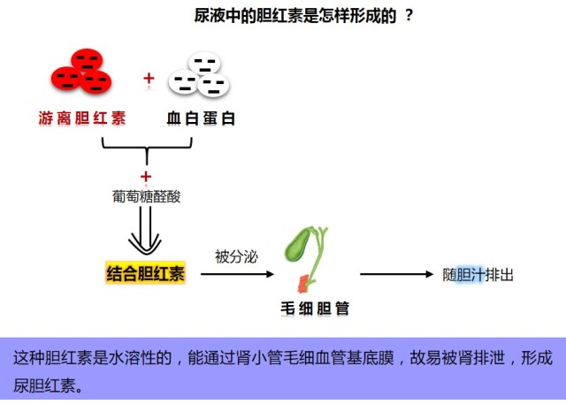 尿液中的胆红素,血液中的胆红素,区别在哪里?