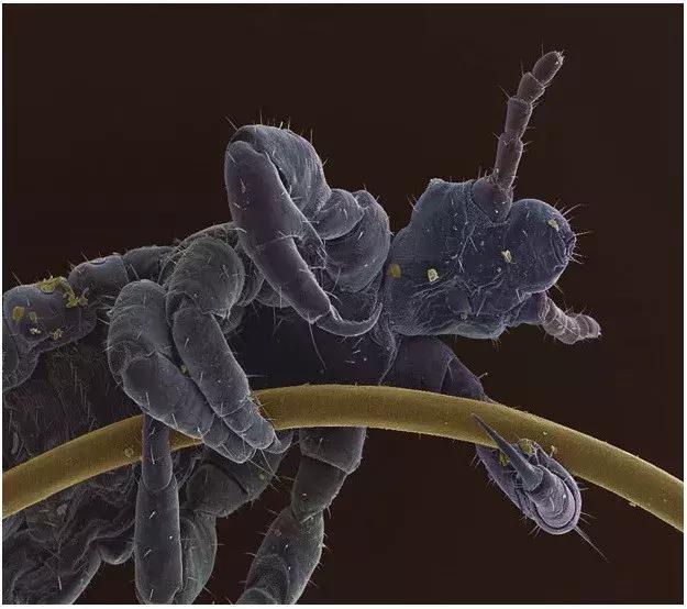 电子显微镜下的可怕世界,完全颠覆了你的想象