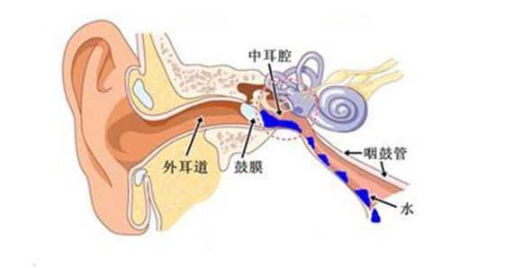 如果出现流鼻涕咳嗽等症状,护理不当极易引发急性中耳炎