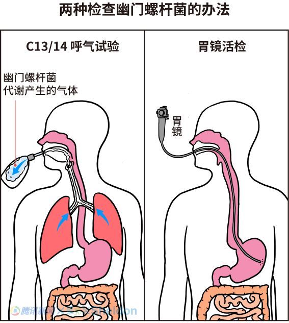 中国一半人口感染胃癌细菌_胃癌手术伤口感染病人(2)