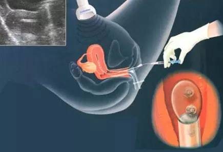 话题 | 单身女冻卵违法,老徐说:有一种生物叫