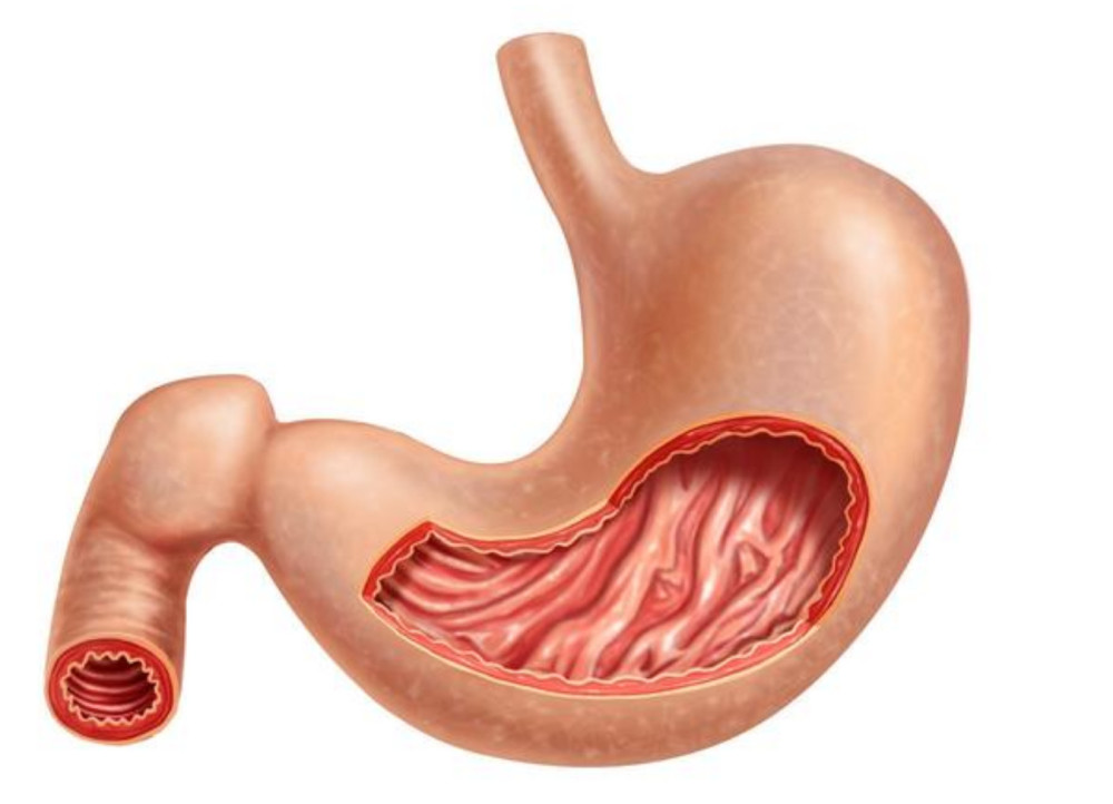 幽门螺旋杆菌是否需要根治,如何根治?李药师为