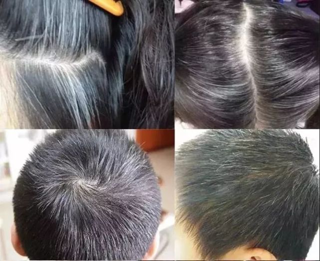 白头发变黑有救星了,教你一个方法,用它洗头解决白发