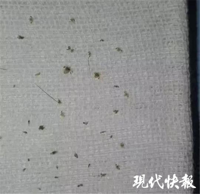 江苏女童眼里竟抓出11只阴虱 很可能是接触不卫生物品