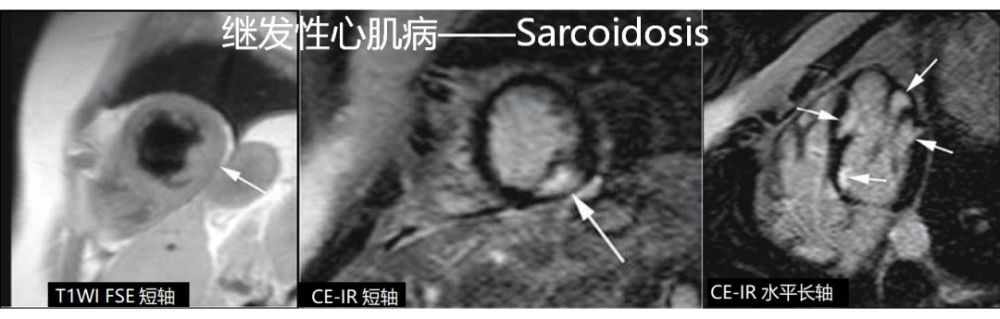 临床i 高清心血管影像诊断图