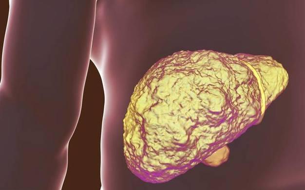 肝不好的人,要时刻警惕自己身体出现变化,及时