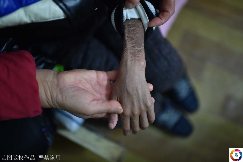 城中村里有个中途宿舍,癌症患儿家庭免费住,