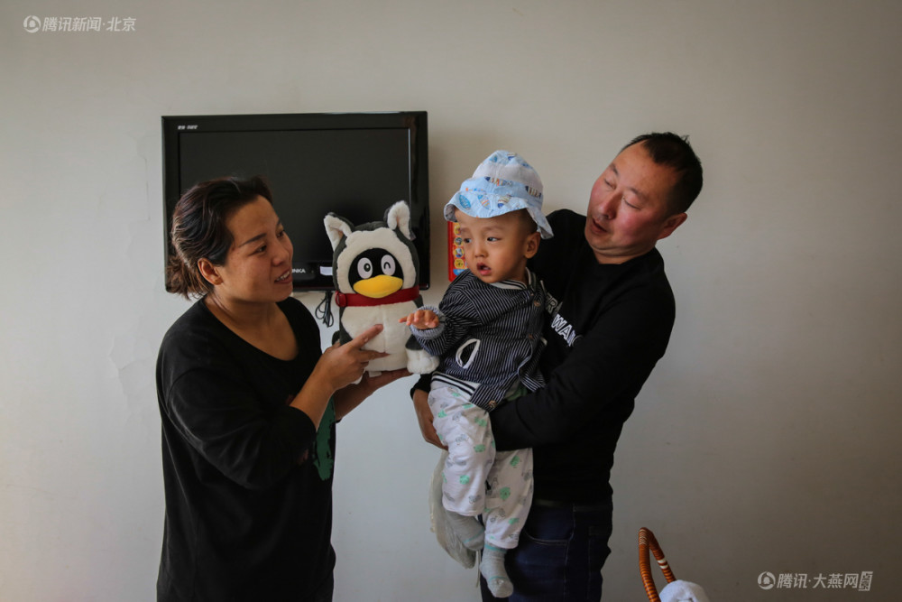 大头娃形似外星人 病危数次幸存下来,5次手术