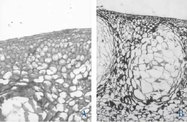 正常柑橘果皮细胞及油胞 图片来源:《柑橘油胞凹陷病组织结构特征的