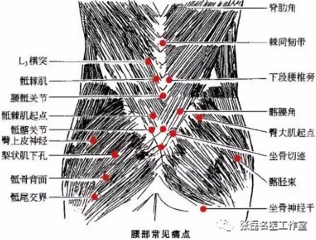 打开腾讯                     脂肪疝又称骶髂筋膜脂肪疝.